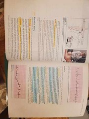EKG Plain and Simple – Paperback, by Ellis RN Karen – Good o