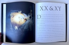 The Sacred Heart 1st Ed 1997 Max Aguilera-Hellweg Medical Photo Surgery Book VTG