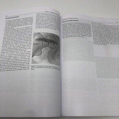 Regional Nerve Blocks in Anesthesia and Pain Therapy Traditional and Ultrasound